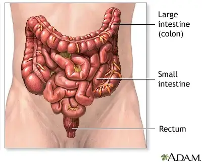 Creștere alarmantă a cazurilor de cancer de colon, la tineri