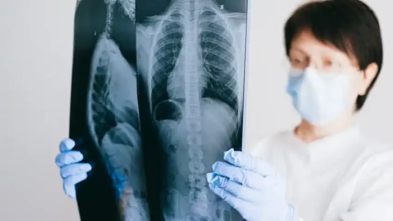 Tuberculoza revine în prim-planul bolilor mortale
