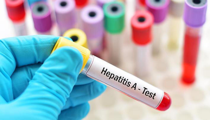 Focar de Hepatită A la Liceul Teoretic „Constantin Șerban” din Aleșd: 9 cazuri confirmate