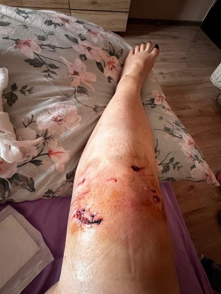 Incident șocant în Oradea. O tânără de 27 de ani, mușcată de un câine pe Bulevardul Dacia