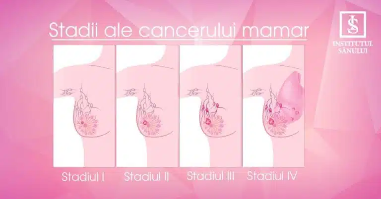 Consultații, investigații și intervenții chirurgicale gratuite pentru patologia sânului