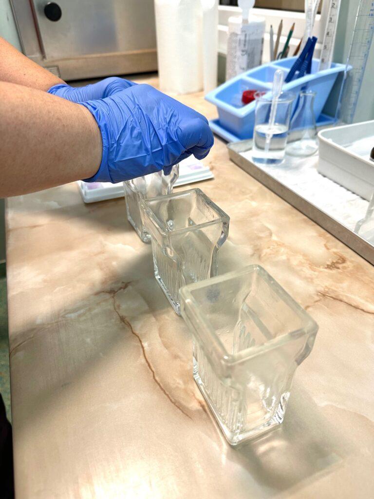 Premieră în Bihor: program de screening pentru o boală genetică rară și gravă